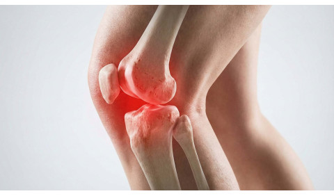 Dor nas articulações: principais causas e orientações práticas